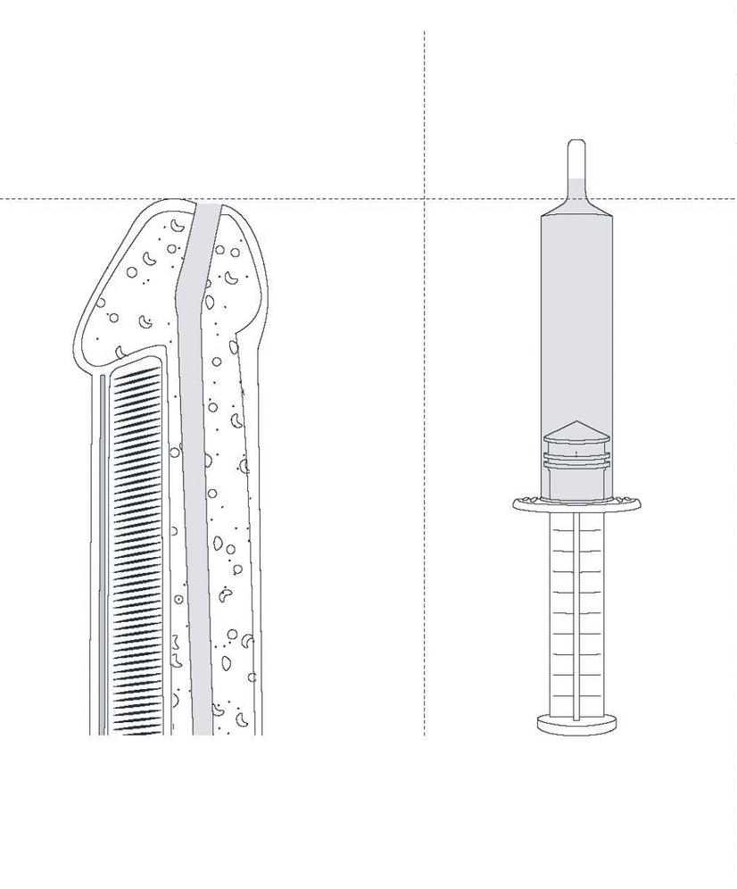 Filling volume of the FARCO®* syringe compared to male urethra